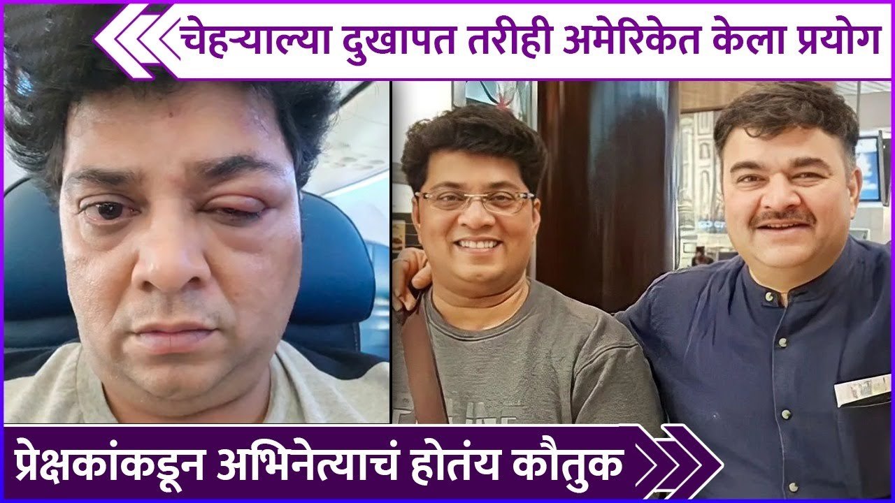 चेहऱ्याल्या दुखापत तरीही अमेरिकेत केला प्रयोग | Atul Todankar