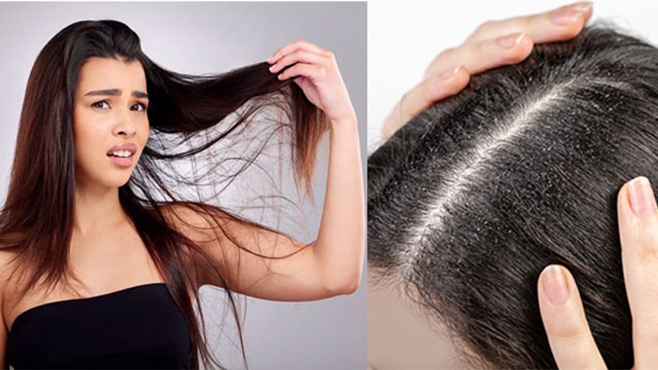 Oily Hair Dry Scalp क्यों होता है | Reason Of Oily Hair |Oily Hair Dry Scalp Ko Theek Krne Ka Tarika