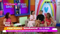 Vanessa Arias preocupa a sus fans tras aparecer con el rostro rasguñado