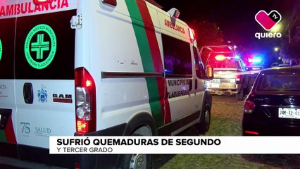 Tlaquepaque: Mujer que sufrió quemaduras a manos de su pareja relata la violencia que vivió