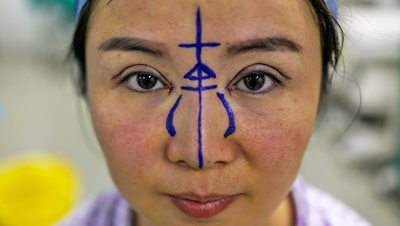 The fake doctors behind Asia's cosmetic surgery...