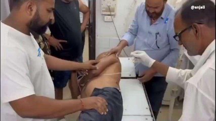 सिवान: हथियार लैस अपराधियों ने लूट का विरोध करने पर युवक को मारी चाकू, PMCH रेफर