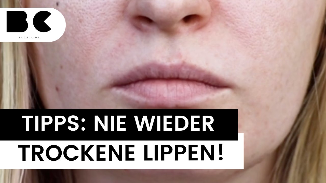 Nie wieder trockene Lippen im Winter!