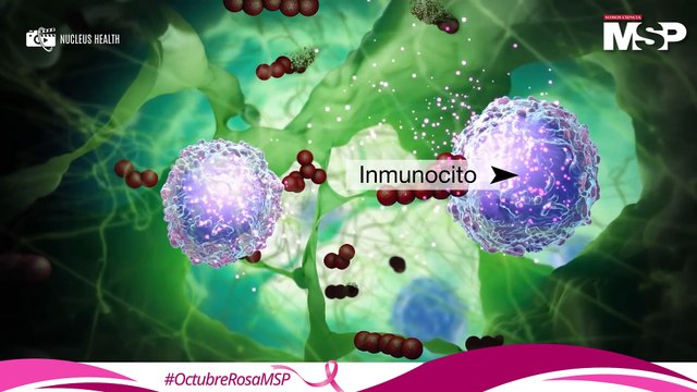 Comprendiendo el cáncer de seno: todo sobre exámenes, etapas y factores de riesgo - #ExclusivoMSP