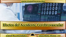 Efectos del Accidente Cerebro vascular