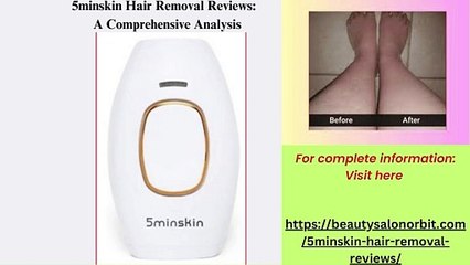 5minskin Hair Removal Reviews: A Comprehensive Analysis