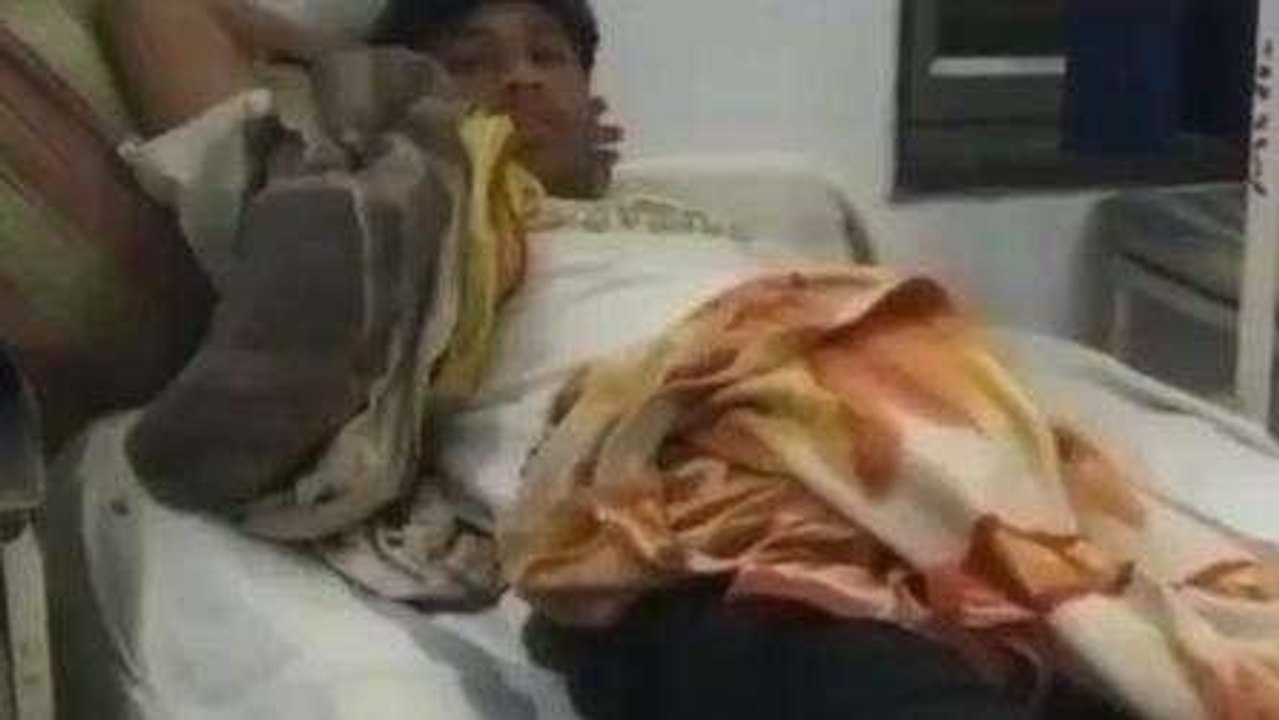 बैतूल: सौच के लिए गए युवक को जहरीले सांप ने काटा, अस्पताल में जारी उपचार