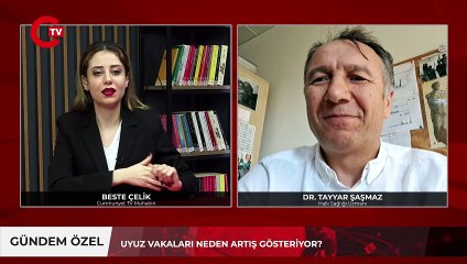 Uyuz vakaları artıyor! Dr. Şaşmaz korunma yöntemlerini tek tek anlattı: ‘Kış aylarında da artabilir’