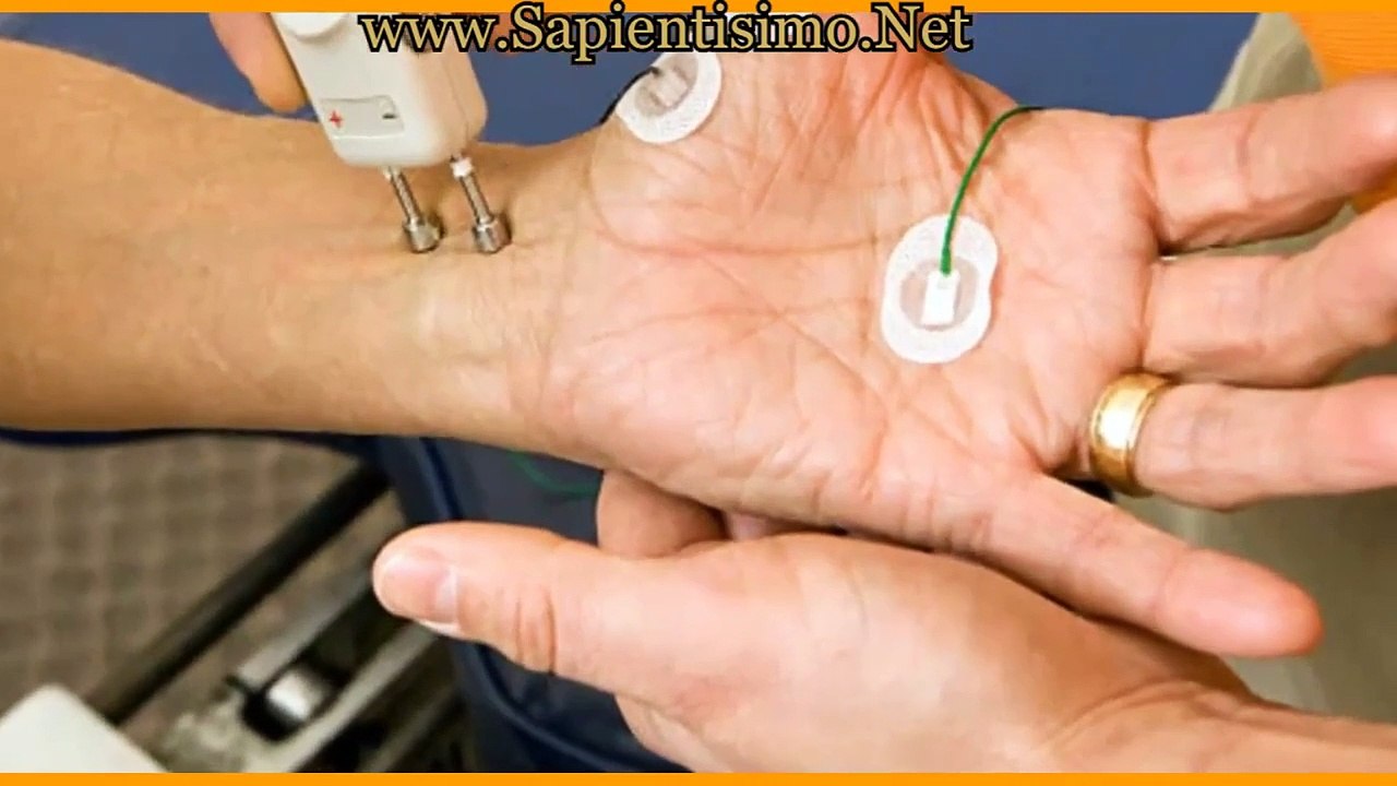 Neuropatía Diabética, Causas, Síntomas y Remedios Naturales