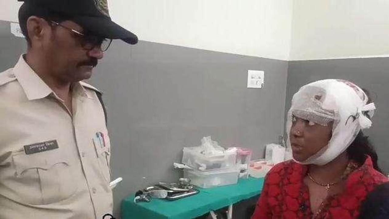 बैतूल: महिला को सास और पति ने बेरहमी से पीटा,गंभीर हालत में अस्पताल में भर्ती