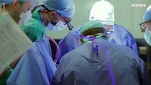 Protesi in simultanea a cuore battente, salvato un paziente a Torino