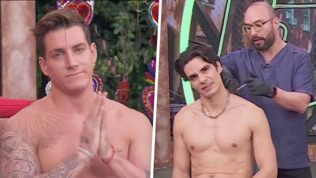 Agustín Fernández y Eduardo Barajas se relajaron con un tratamiento de toxina botulínica en vivo