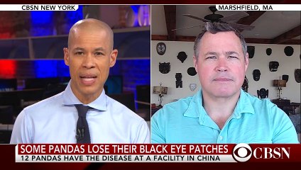 Giant panda disease is causing distinctive hair loss