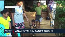 Tidak Miliki Biaya Anak 3 Tahun Hidup Tanpa Anus