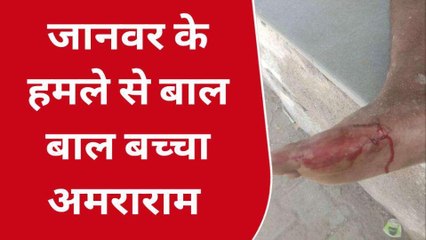 अजमेर: जंगली जानवर के हमले का मामला, जानें अमरा राम की हेल्थ का ये अपडेट