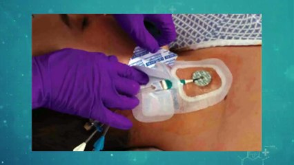 Bard Powerport catheter lawsuit Complications  _ 2023 catheter injury Updates