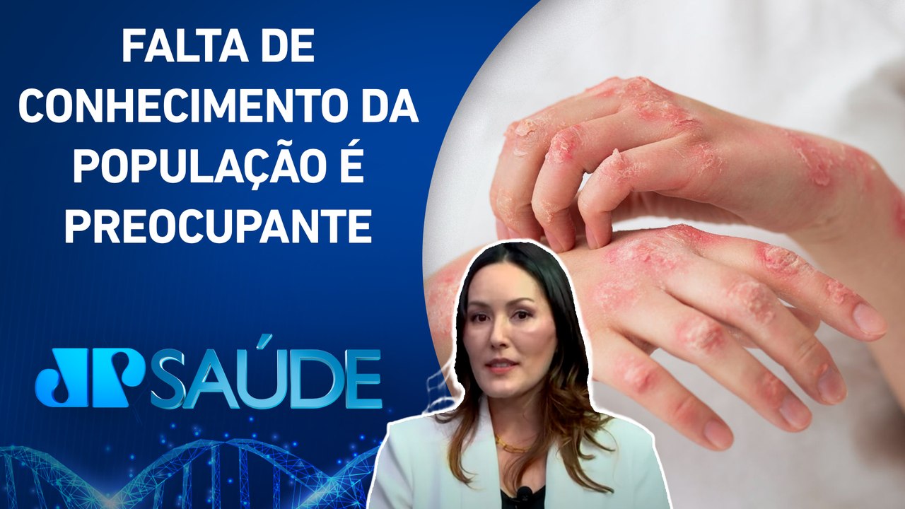 Doenças autoimunes: Dia mundial da psoríase visa informar e combater estigmas sociais | JP SAÚDE