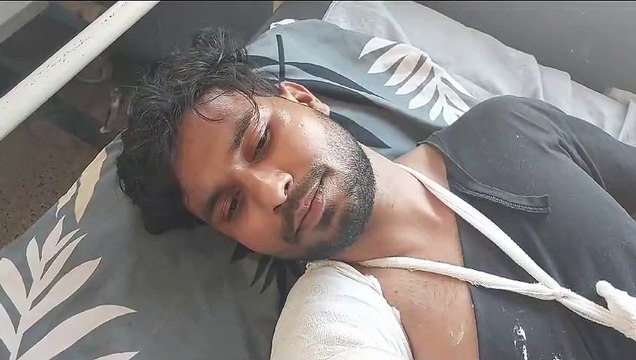 जिम में प्रतिद्वंदी से जोर आजमाइश करना युवक को पड़ा भारी, पंजा लड़ाते समय टूटा हाथ