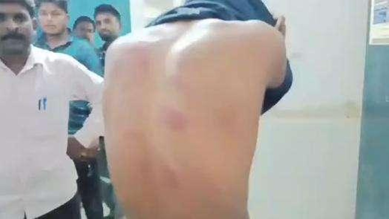 खगड़िया: 10वीं कक्षा के छात्र को शिक्षक ने पीटा, सुनिए क्या बोला नाबालिग..