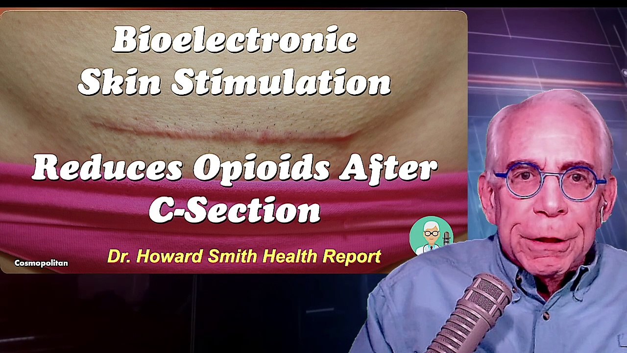 Bioelectronic Skin Stimulation Reduces Opioid Need After C-Section