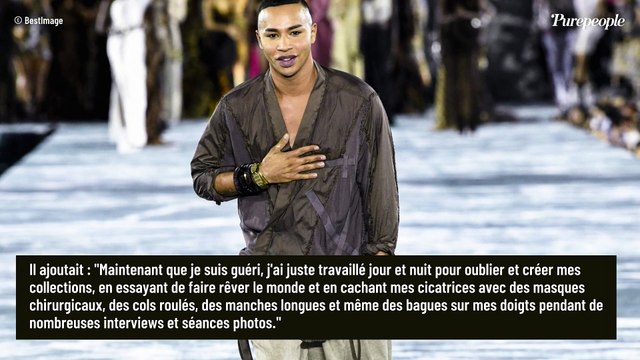 Olivier Rousteing, photo de son visage et de son corps brûlés : une explosion qui aurait pu lui coûter la vie