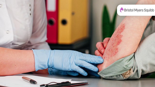 Enfermedades cutáneas similares a la psoriasis proceso del diagnóstico diferencia