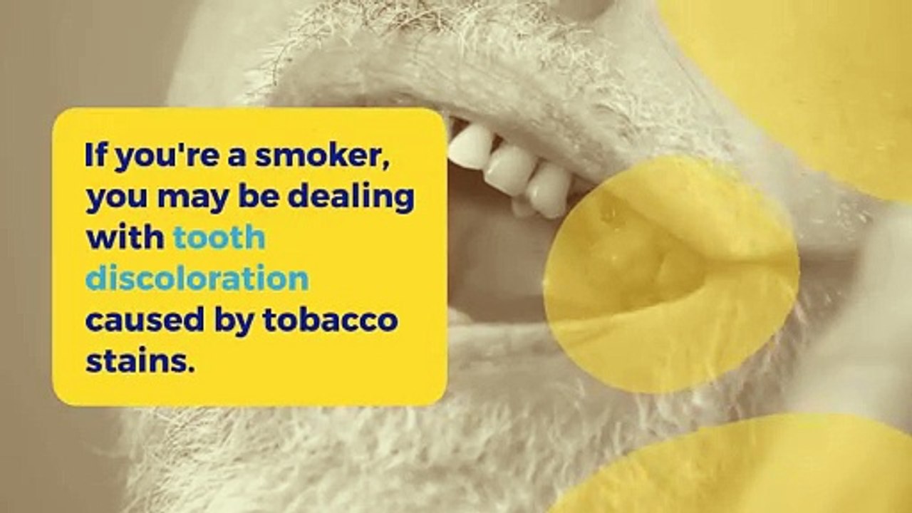 Teeth Whitening for Smokers Is It Effective and Safe? video Dailymotion