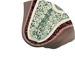 Compressive S - Simple placement _ prosthetic procedure - V1 - 320x320