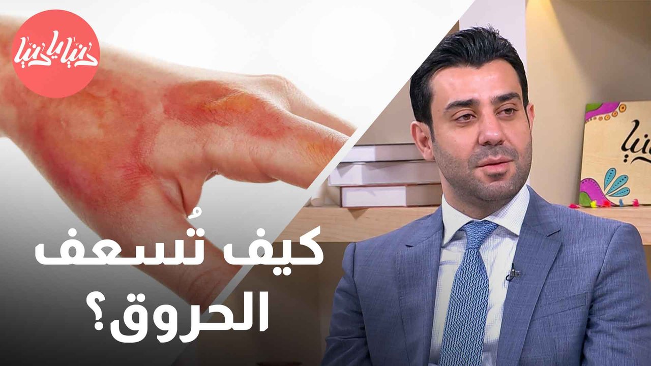 دليل السلامة والاستجابة السريعة للتعامل مع الحروق بأنواعها