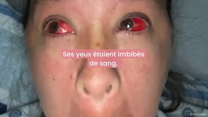 Son accouchement ne se passe pas comme prévu