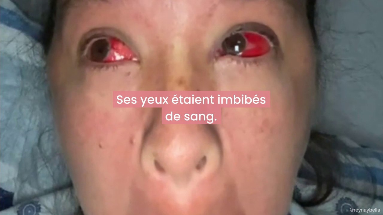 Son accouchement ne se passe pas comme prévu