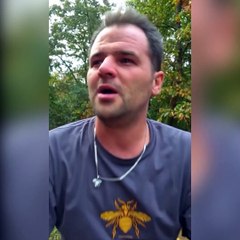 Fenomen olmak uğruna canından vazgeçti! Arı iğnesiyle 'botoks'