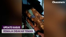 7 Hari Dirawat di RS, Remaja Dibakar Teman di Deliserdang Meninggal Dunia