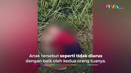 Fakta Mengejutkan Balita Kondisi Gizi Buruk di Semak-semak