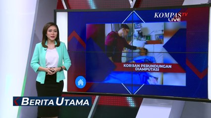 Dugaan Perundungan, Kaki Siswa SD di Bekasi Diamputasi