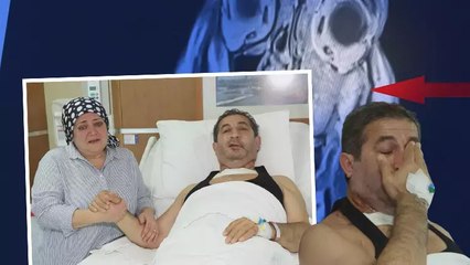 Diş ağrısı sandı yanağında ileri evre kanser çıktı