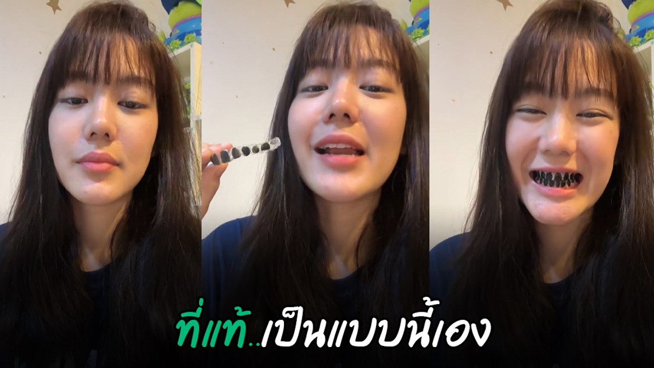 อึ่ง พรหมลิขิต เฉลยความลับฟันดำ ที่แท้ แค่ใส่สิ...