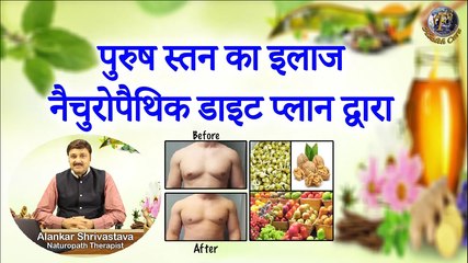 पुरुष स्तन का इलाज नैचुरोपैथिक डाइट प्लान द्वारा | Naturopathic Diet Plan For Gynecomastia |