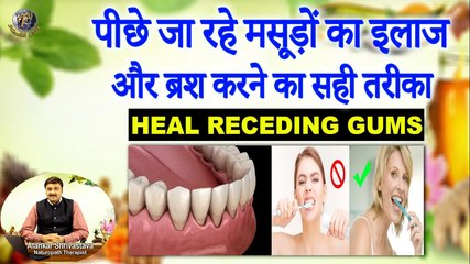 पीछे जा रहे मसूड़ों का इलाज और ब्रश करने का सही तरीका | Heal Receding Gums | Right Brushing Technique