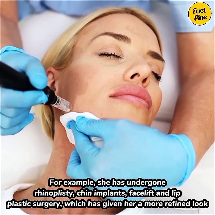 Secrets of Hollywood Beauty: 7 Celebrities Who Enhanced Their Looks with Plastic Surgery!