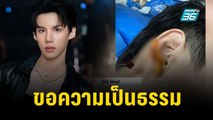 นักแสดงหนุ่มร่ำไห้ ขอความเป็นธรรม โดนช่าง “ตัดหู” | เที่ยงทันข่าว | 6 พ.ย.66