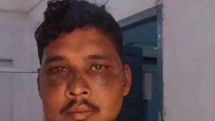 मधुबनी: आर्केस्ट्रा कलाकार पर जानलेवा हमला, स्थिति नाजुक