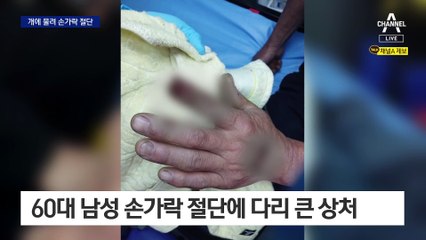 손가락 잘렸는데 “우리 개는 안 물어요”