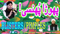Phora Phunsi | Blisters | Pimples | Wazifa|Vird| Dabistan Al-Ahqar Al-Attari | Muhammad Tariq Rashid