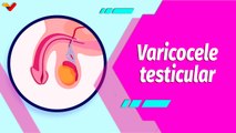 Buena Vibra | ¿Qué es el varicocele y cómo puede afectar la fertilidad masculina?