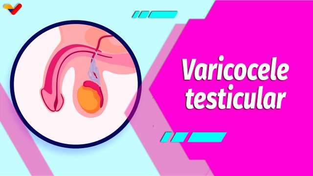Buena Vibra | ¿Qué es el varicocele y cómo puede afectar la fertilidad masculina?