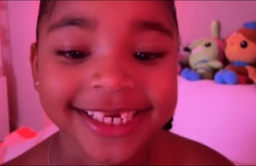 Khloe Kardashian's daughter True has lost another tooth