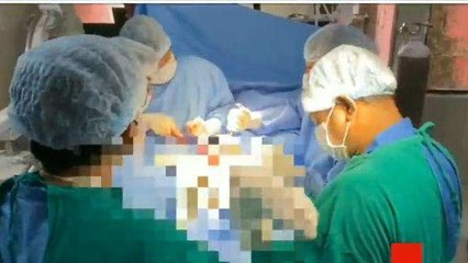 मिर्ज़ापुर के डॉक्टरों ने रचा इतिहास... पहली बार हुई ये सफल सर्जरी