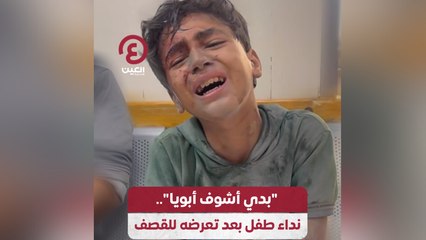 "بدي أشوف أبويا".. نداء طفل بعد تعرضه للقصف