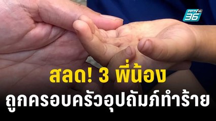 สลด! 3 พี่น้อง ถูกครอบครัวอุปถัมภ์ทำร้าย-ใช้แรงงาน | เข้มข่าวค่ำ | 7 พ.ย. 66